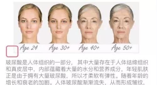 玻尿酸有什么用处图5