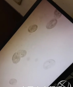 又出新病！这些鳜鱼病害该如何防治