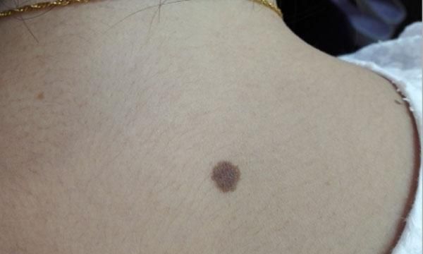 不喜欢晒太阳的人，可能会错过6个好处，现在了解不迟