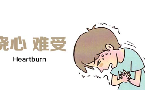 怎样治疗食管反流性胃炎?肠胃专家帮你解决问题