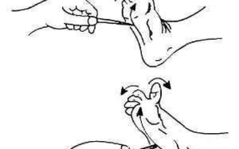 巴宾斯基征检查脑膜刺激征(巴宾斯基征阳性属于脑膜刺激征吗)