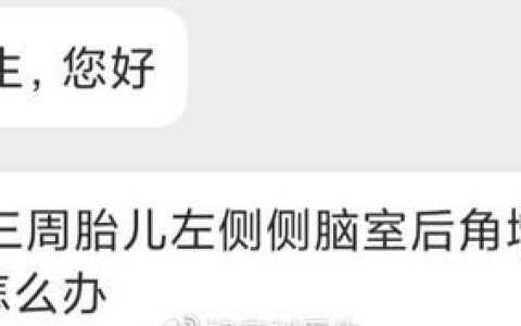 侧脑室增宽孩子一定有问题吗