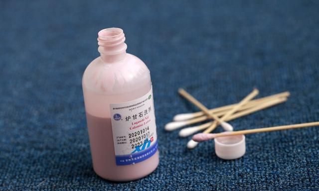 号称“万能皮肤药”的炉甘石洗剂，究竟应该怎么用？