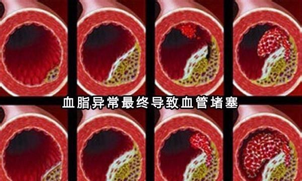 吃动物油会高血脂吗,吃动物油会引起高血脂吗图3