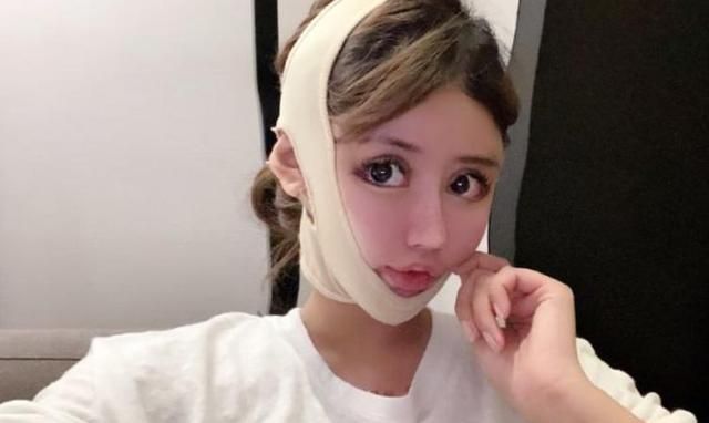 “整容上瘾”女生自述：从16岁开始整容，手术上百次，花费300万