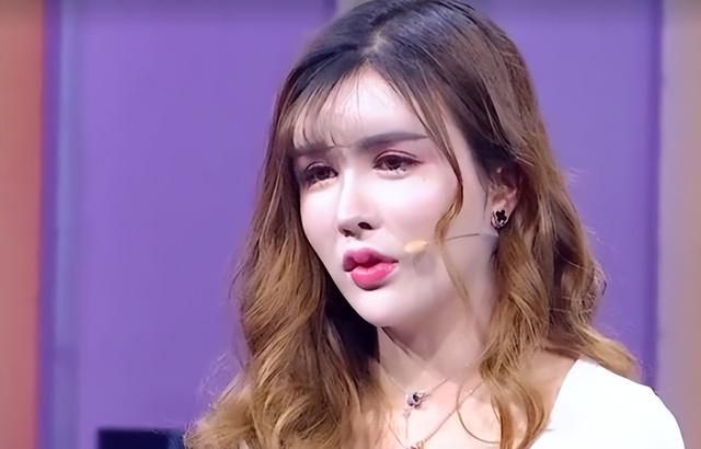 “整容上瘾”女生自述：从16岁开始整容，手术上百次，花费300万