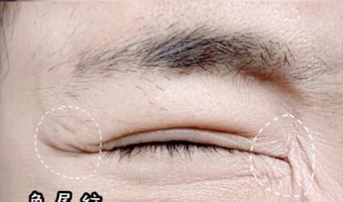 注意！眼部细纹很容易出现，只需记住这7个秘诀，你远离眼部细纹