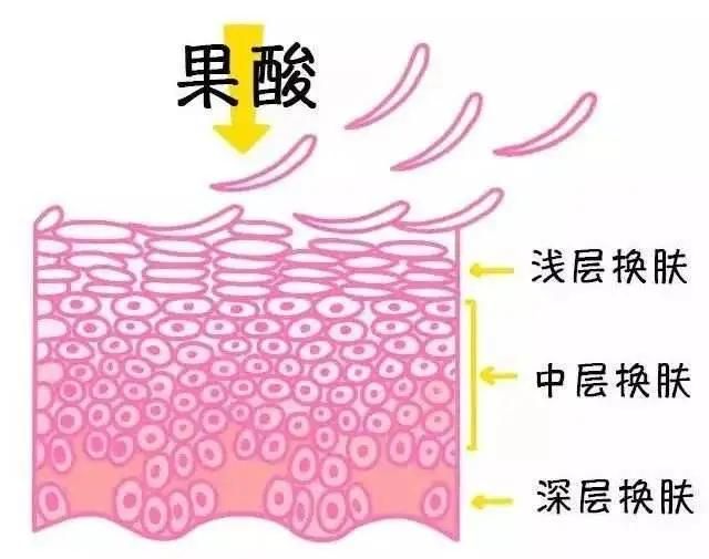 长痘？烂脸？扒扒医美“内幕”，做什么才是性价比之王