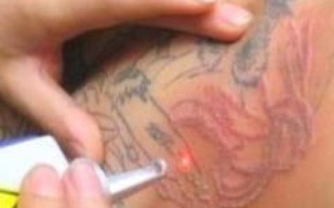 如何清洗掉身上的纹身