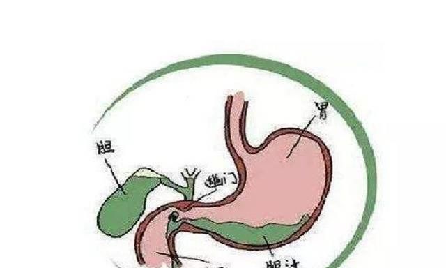 胆汁在人体中起什么作用(胆汁对脂肪起什么作用)图4