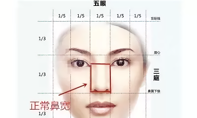 鼻翼缩小怎么缩？究竟缩小了哪里？