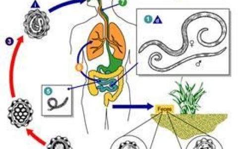 成年人蛔虫病症状表现,中年人有蛔虫病的症状