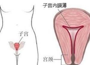 子宫内膜薄能做试管吗什图3