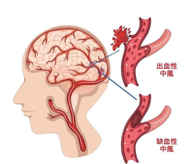 现代药理学及古中医对巴戟天的认识