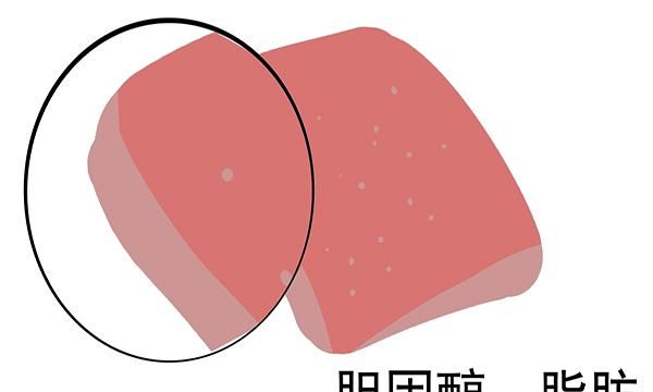 哪种油最不健康？是不是大豆油？老实说：4种油更应该少吃