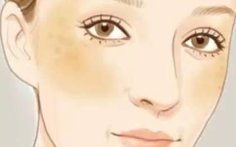 七白散面膜治黄褐斑的比例(自制七白散面膜用了脸发黑)