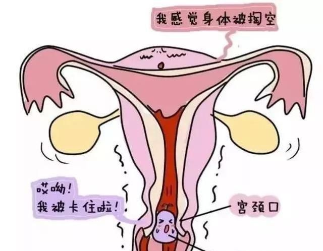 一组漫画告诉你：药流和人流的全过程！