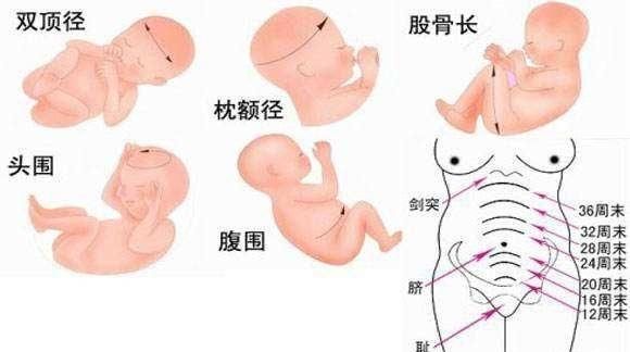 孕38周怎么测胎儿体重图3