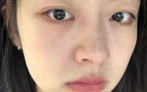 怎样不挤黑头就可以让黑头消失,怎么用最简单的方法去掉黑头