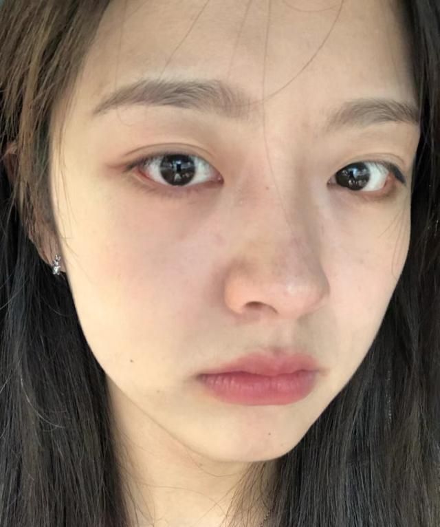 黑头究竟怎么去？别挤黑头！教你用正确的方法10分钟消灭黑头