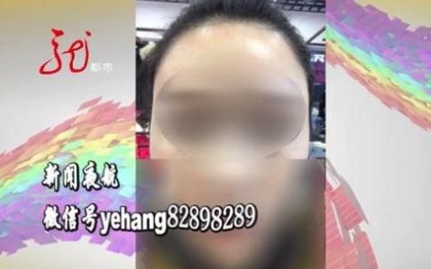 太阳穴填充手术，哈尔滨女子做太阳穴填充，太阳穴没啥变化，身上多了好几个坑！增肥10斤都没恢复