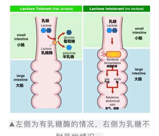 怎样选择适合宝宝的乳糖酶图1