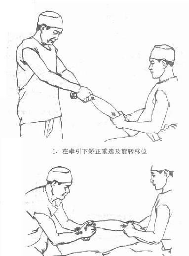 中医接骨七天痊愈是真的吗,中医接骨七天恢复真的吗图3