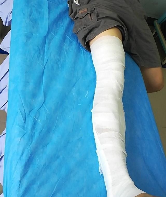 中医接骨七天痊愈是真的吗,中医接骨七天恢复真的吗图5