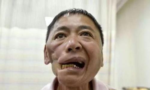 槟榔是什么东西，它到底有什么作用？为什么年轻人都喜欢嚼槟榔？