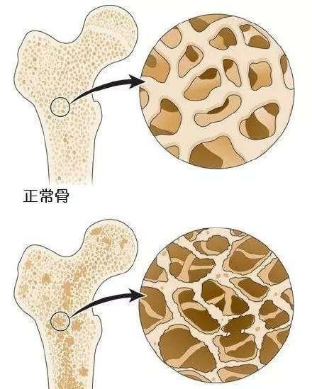 如何保证骨骼健康,如何保持骨骼的健康图2