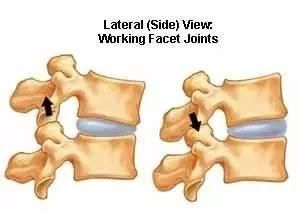 慢性腰痛敷热盐效果怎样呢(慢性腰痛敷热盐的方法)图2