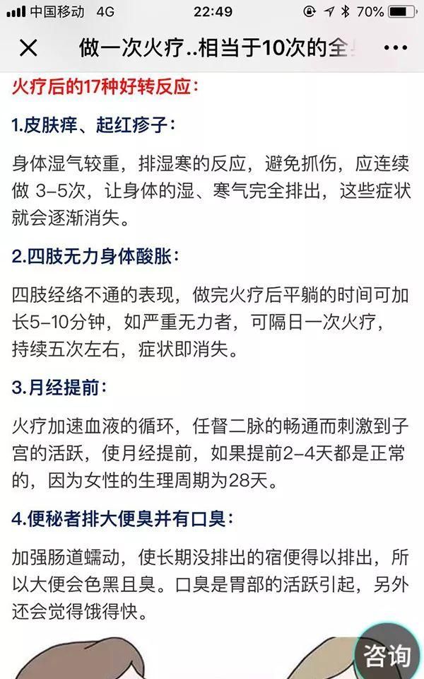 笑喷！中医专家一句话点评权健火疗：和毛巾热敷没有区别