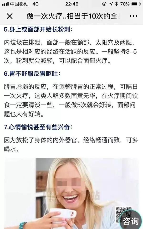 笑喷！中医专家一句话点评权健火疗：和毛巾热敷没有区别