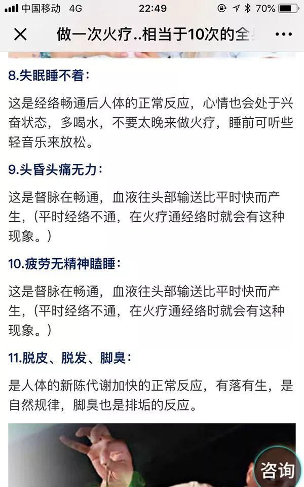 笑喷！中医专家一句话点评权健火疗：和毛巾热敷没有区别