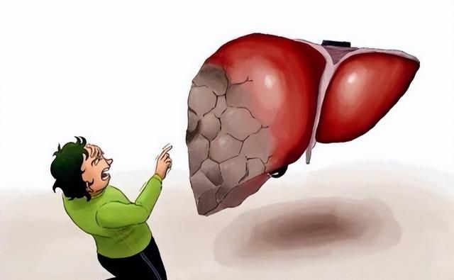 肝是哑巴，胃是喇叭，肝不好，胃会告诉你，一个中成药，肝胃同治