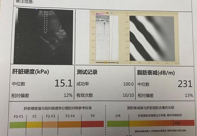 乙肝一二十年了，肝功一直正常，需不需要吃保肝护肝药