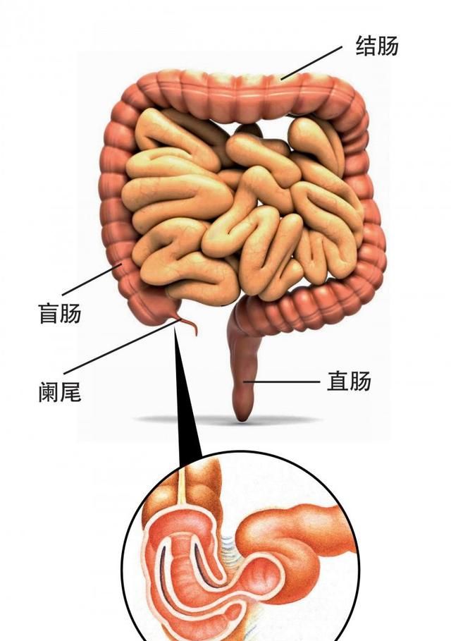 阑尾炎切除术后的调养，中医调理更胜一筹