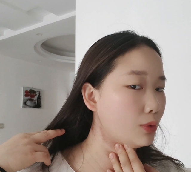 自用泥灸的分享