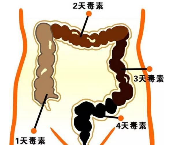 长期便秘怎么办？西医教你4个小方法，润肠通便，不再被便秘困扰