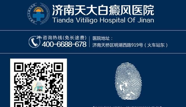 白癜风患者生活中的4大禁忌，不容忽视