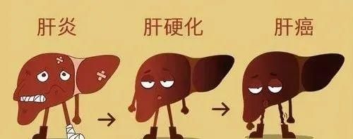 乙肝可以治愈吗？感染后该怎么办？详细解答来了→