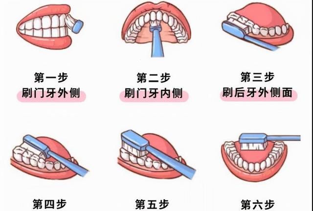 牙缝里的牙结石，如何清除干净？3个办法是不少人的选择