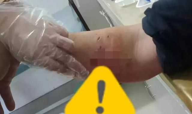 饿狼进村：咬死10只鸡，咬伤2条狗和6个人，其中1人耳朵被咬坏