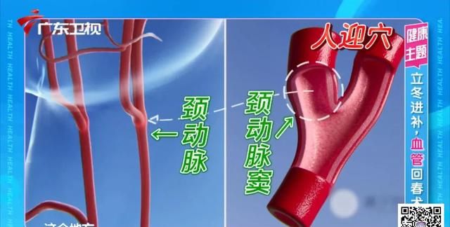 汤中加丹参，活气又行血，让你的血管更加「年轻」