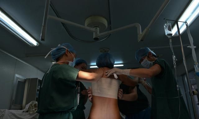 90后女子隆胸手术全程