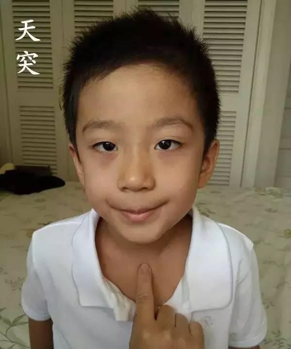 反复高烧不退，咳到痰中带血，这一波势头特猛的流感怎么应对