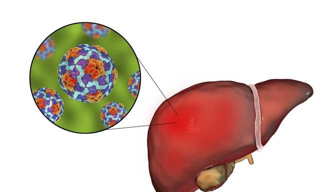 肝炎的治疗方法不外乎就是这三种，大家要擦亮眼睛谨防被骗