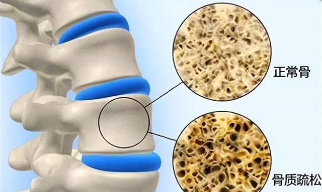 吃虾皮不能补钙？医生：真正补钙的3种食物，多数人却不爱吃