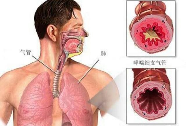 氨茶碱片有什么功效,螺内酯片和氨茶碱功效一样吗图3