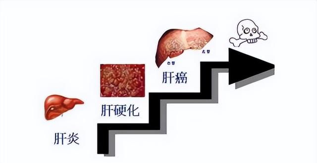 丙肝的认知常识和3大类型，有必要了解一下